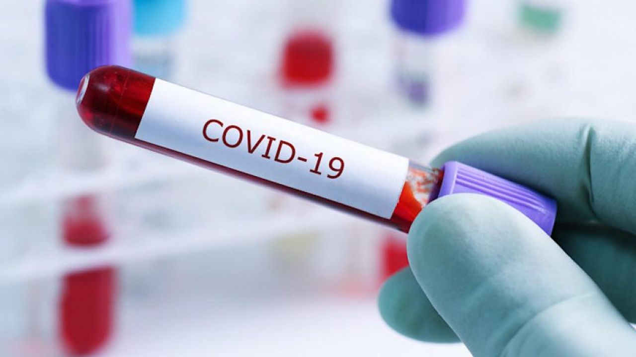 Güney Kıbrıs'ta haftalık koronavirüs rakamları açıklandı