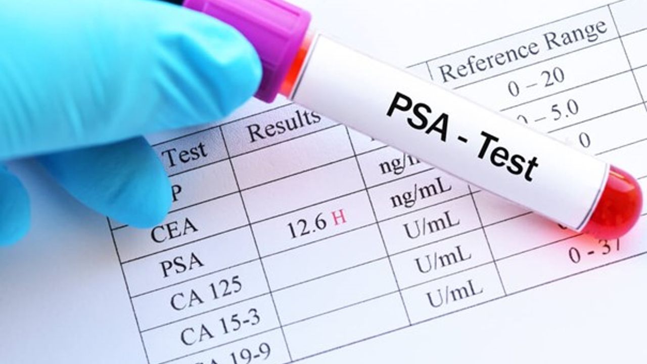 1-31 Mart prostat kanseri farkındalık ayı dolayısıyla KHYD ve YDÜ Hastanesi iş birliğinde ücretsiz PSA testleri yapılaca