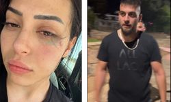 Kıbrıslı Türk genç kızın Ay. Napa’da darp edilmesi olayı mahkemeye intikal ediyor
