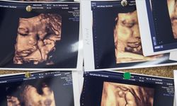 Çoğul gebelik oranları Kovid-19 sonrası dünya genelinde artışa geçti