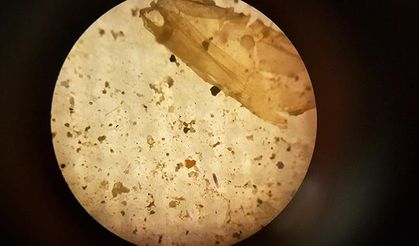 İnsanlar, günde on binlerce mikroplastik parçacığı soluyor olabilir