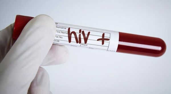 Resmi kayıtlara göre Türkiye'de 32 bin 376 kişi HIV ile yaşıyor