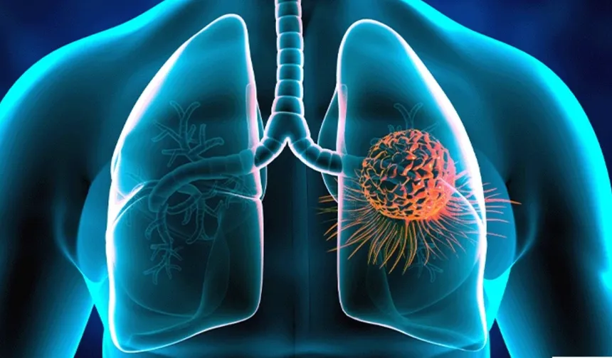 Dünyada erkeklerde en sık "akciğer", kadınlarda da "meme kanseri" görülüyor